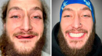 53 Dental Work That Made People Smile Without Hesitation And Shame