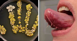 69 Unusual Medical Photos That Land Somewhere In Between Science And Nightmare