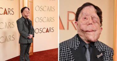 Adam Pearson Joins Fans In Calling Out Comedian’s Offensive Tweet About Him