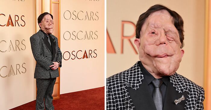 Adam Pearson Joins Fans In Calling Out Comedian’s Offensive Tweet About Him