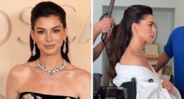 Anne Hathaway Reveals ‘Trick’ Behind Taut Face After Fans Scrutinized Her Oscars Appearance