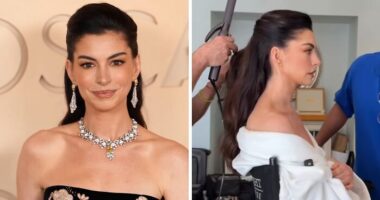 Anne Hathaway Reveals ‘Trick’ Behind Taut Face After Fans Scrutinized Her Oscars Appearance