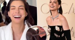 Anne Hathaway shares the instant facelift hack she used for the Oscars 2026 red carpet