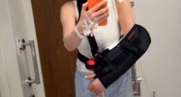 Anthea Turner says she is in 'pain' after suffering a 'nightmare' injury forcing her to have surgery and wear a sling for three weeks