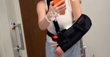 Anthea Turner says she is in 'pain' after suffering a 'nightmare' injury forcing her to have surgery and wear a sling for three weeks