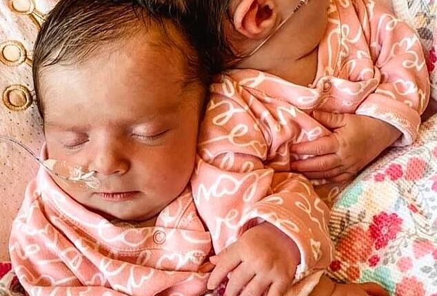 Liliya was speechless at the beauty of her baby girls Abigail and Micaela