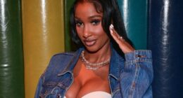 Bernice Burgos Shares Progress Update After Undergoing Recent Refinement Cosmetic Surgery