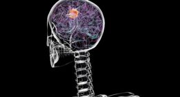 The document, produced in February 1951 and declassified in 2014, summarizes a Soviet scientific paper that examined striking similarities between parasitic worms and cancerous tumors