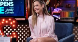 Denise Richards shares before-and-after photos of shocking facelift transformation