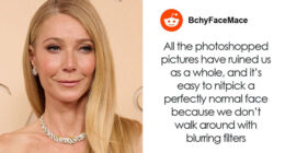 Doctor Reveals Reason Behind “Tired Eyes” That Has Stars Looking Sleepy Despite Youthful Faces