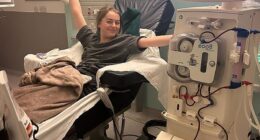 Maya Solecki celebrating her last session of dialysis before her transplant. In a desperate bid to find a donor her mother,  Maria Solecki, took the decision to take her appeal to her local newspaper, the Southend Echo, in March 2025