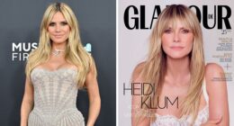 Heidi Klum reveals she suffers from a disorder that she partly credits for her success