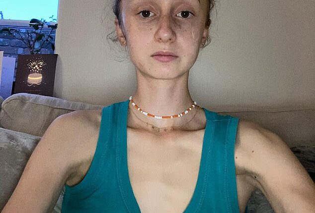 At just 15, Eloise Trunchion became hooked on so-called ¿Skinnytok¿ and ¿Fitspo¿ social media posts and vlogs over lockdown