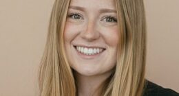 After Bailey Turner, 27, got Botox in her jaw to alleviate pain, she said she wasn't able to fully smile and felt like her face was 'frozen.' She's seen before the injections