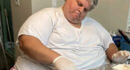 Jamie Fisher, from southern Florida, once tipped the scales at 715lbs