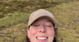 Charlotte was diagnosed with a deviated septum at the age of 15