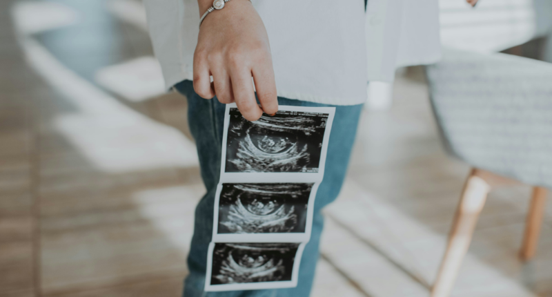 sonogram