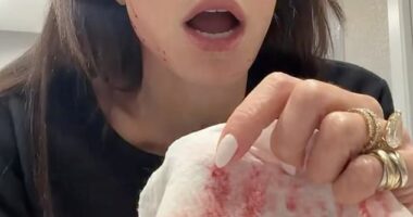 Recent news of former Real Housewife Bethenny Frankel (pictured) clutching a blood-soaked cloth after slicing her face open with a cupping device has sparked fresh concern over the risks of at-home beauty tools