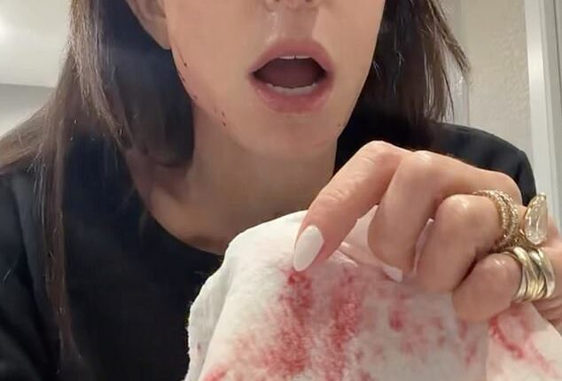 Recent news of former Real Housewife Bethenny Frankel (pictured) clutching a blood-soaked cloth after slicing her face open with a cupping device has sparked fresh concern over the risks of at-home beauty tools