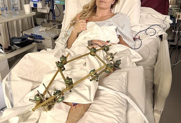 Lindsey Vonn has incredibly dismissed claims her skiing career is over after her recent crash
