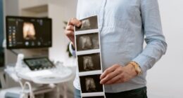 woman holding ultrasound photos