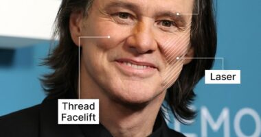 Plastic surgeons weigh in on Jim Carrey's latest transformation after being branded unrecognizable