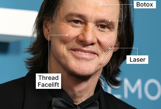 Plastic surgeons weigh in on Jim Carrey's latest transformation after being branded unrecognizable