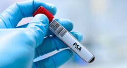 The Daily Mail, along with the charity Prostate Cancer UK, has long campaigned for men to be offered regular blood tests