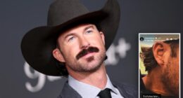 Riley Green left bleeding after fan hurls phone at country star onstage during concert