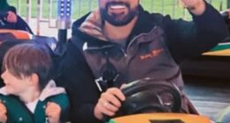 Rylan Clark took to his Instagram Stories to show off the results of his latest 'traumatic and invasive' facial procedure on Monday