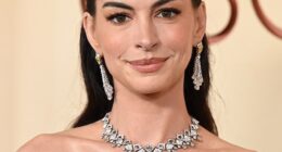 Cosmetic surgeons and aestheticians have said the 98th Academy Awards marked the end of old A-lister beauty standards after Anne Hathaway (pictured), Nicole Kidman, and Gwyneth Paltrow debuted the 'new Hollywood face'