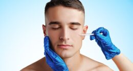 More and more men across Ireland are said to be embarcing cosmetic procedures