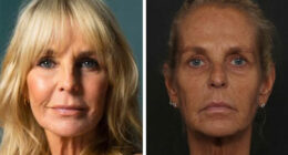 Ulrika Jonsson, 58, Reveals The Six Months Of Treatments Behind Her Dramatic Transformation