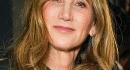 Nancy Shevell makes sure to protect her skin from the sun - and it pays off, says Dr Ross Perry of Cosmedics