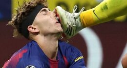 Barcelona star Fermin Lopez took a boot to the face during their trip to Atletico Madrid