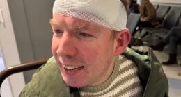 Britain's Got Talent winner Lost Voice Guy was rushed to hospital after he split his head open following a horror fall