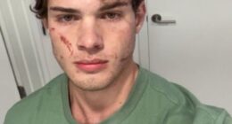 Clavicular has revealed that he is home after being rushed to the hospital following a suspected overdose amid an unsettling livestream that suddenly ended on Tuesday night