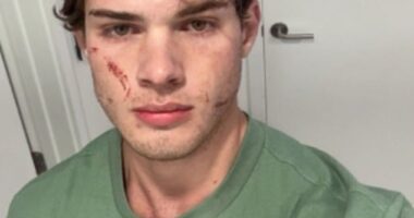 Clavicular has revealed that he is home after being rushed to the hospital following a suspected overdose amid an unsettling livestream that suddenly ended on Tuesday night