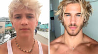 From Bone Smashing To Chin Extensions, Here Are Before-And-After Collages Of “Looksmaxxing” Influencers