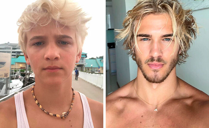 From Bone Smashing To Chin Extensions, Here Are Before-And-After Collages Of “Looksmaxxing” Influencers