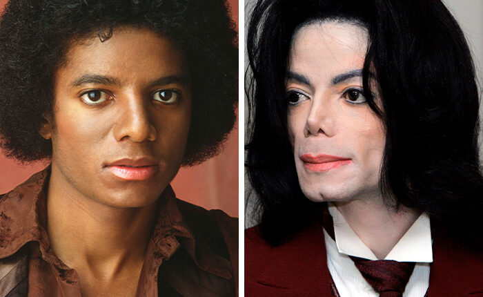 How The Jackson Family Transformed Through The Years Because Of Plastic Surgery