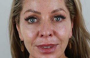 As the Real Housewives of London castmate Juliet Mayhew (pictured before her facelift) approaches 50, ageing, inevitable for anyone, has become harder to ignore, she told the Daily Mail