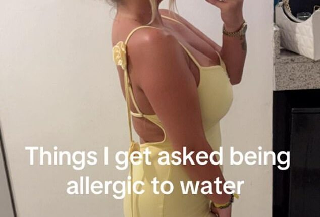 Chelsea, 23, has a severe allergy to water and it makes life extremely difficult