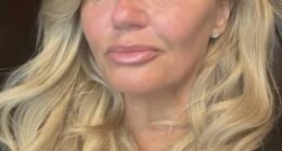 Kerry Katona has issued a new health update after suffering a suspected stroke, explaining it has left her looking and talking differently