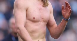 Haaland shows off his battle wounds after a physical tussle with Arsenal centre back Gabriel