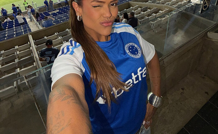 This Influencer Removed A Vein From Her Forehead Because It Bothered Her Aesthetically And Shared The Results