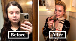 Woman Shows Her Crazy Transformation, People Can’t Believe It: “Lip Fillers, Botox, Weight Loss”