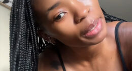 Woman&rsquo;s Breasts Regrow After Undergoing Reduction, Leaving Internet Baffled