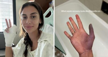 Young Woman Issues Urgent Warning About Going To Nail Salons After She Ended Up In The Hospital