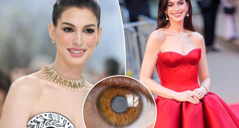 Anne Hathaway's secret decade-long medical condition left her nearly blind throughout her 30s